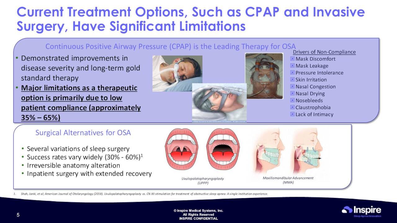 Current Treatment Options, Such as CPAP and Invasive